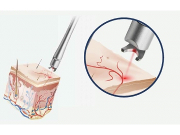 Láser Diodo 980nm, para Eliminar Varices