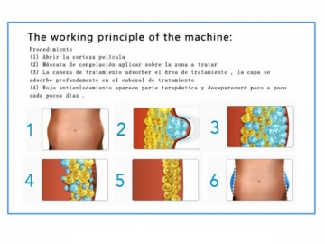 Máquina de criolipolisis Kam-607